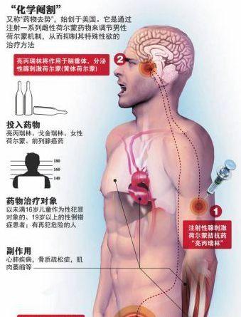 化学阉割成多国的执法领域的惩罚手段，那是通过手术切除吗?